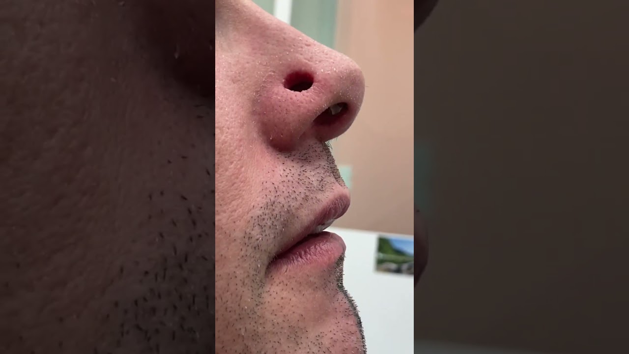 Lo que piensa tu mam&aacute; cuando le dices que quieres hacerte un piercing #piercing #nostril #bcn