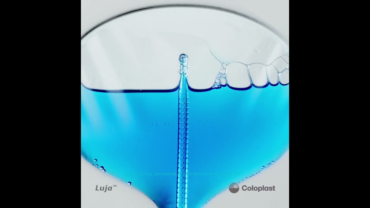 Demo zur Blasenentleerung mit Luja im Vergleich zu herk&ouml;mmlichen Kathetern