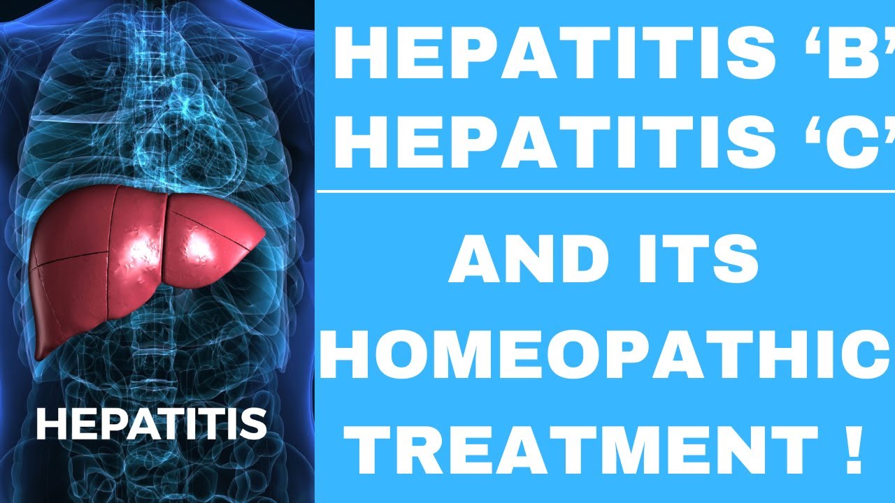 HEPATITIS B || HEPATITIS C || BEST HOMEOPATHIC MEDICINE FOR HEPATITIS B !