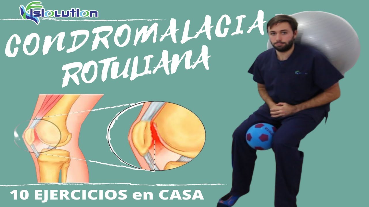 CONDROMALACIA ROTULIANA - 10 EJERCICIOS y RECOMENDACIONES | Fisiolution