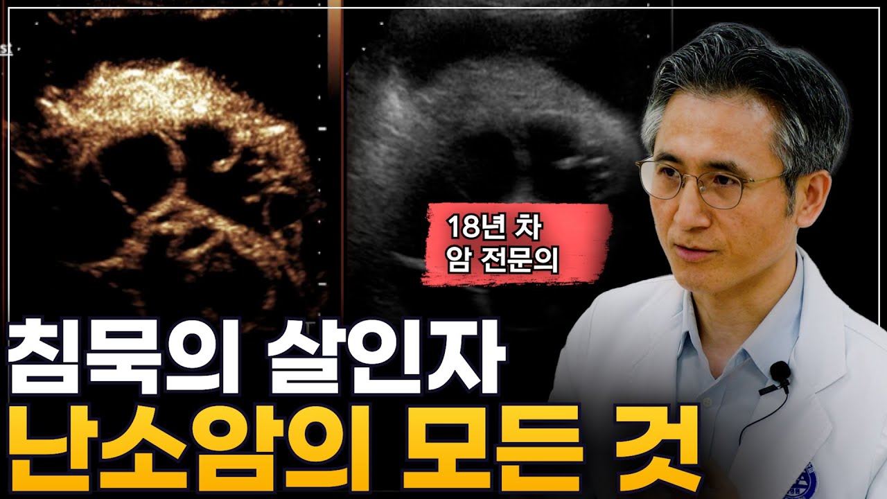 침묵의 암 ‘난소암’, 이 영상 하나로 진단부터 치료까지 완전 정복