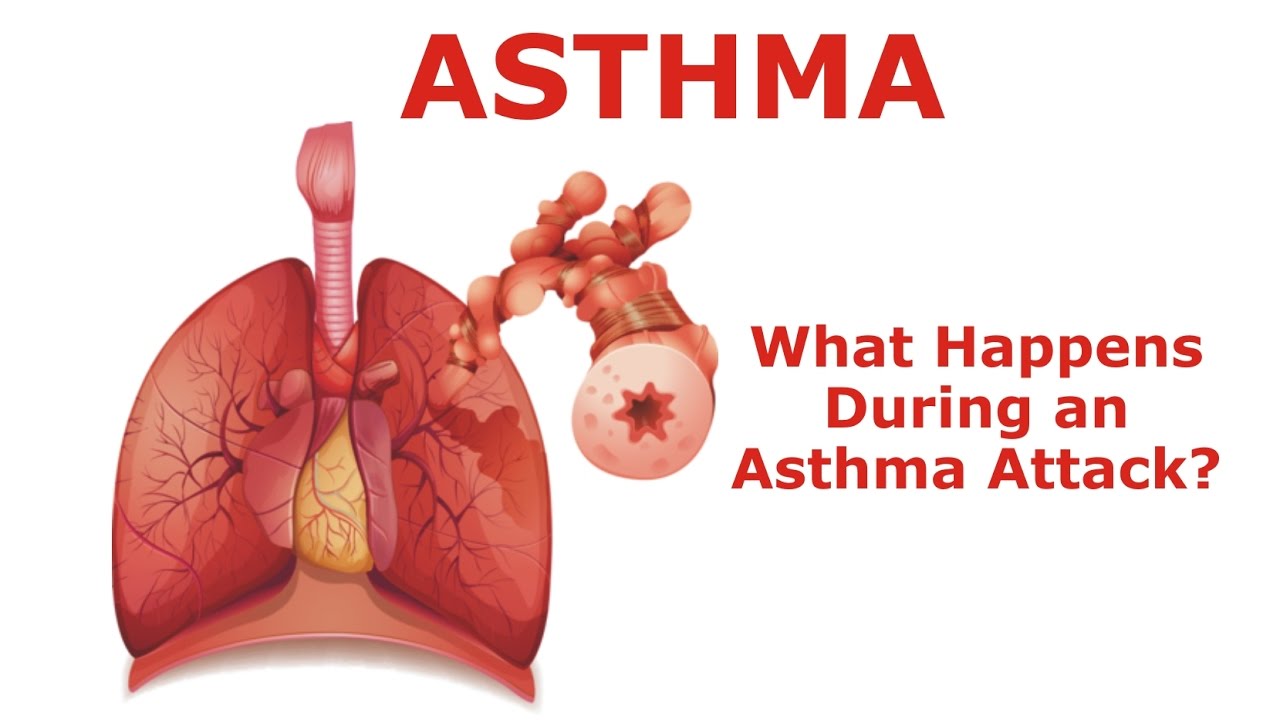 Asthma - What Happens During an Asthma Attack?