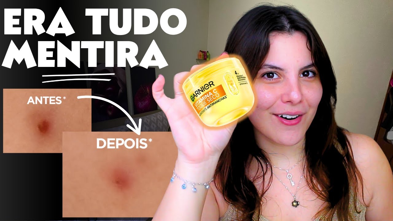 PELE MANCHADA hidratante garnier com vitamina C, FUNCIONA?