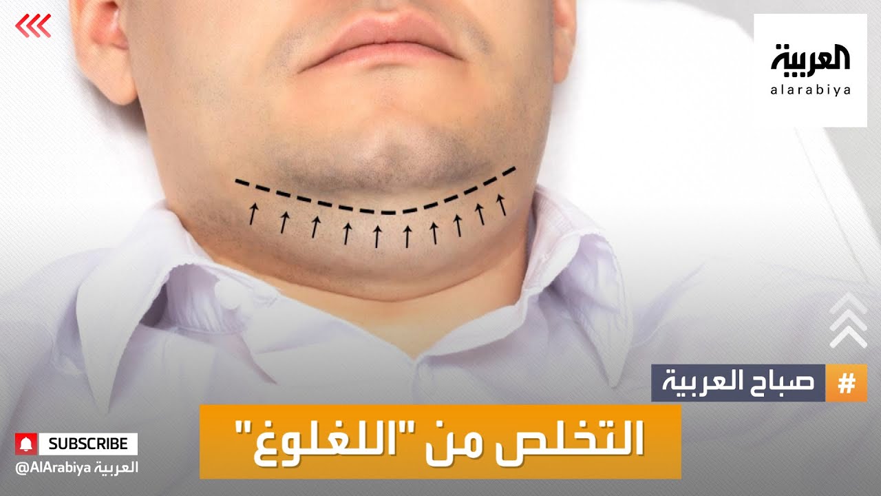 صباح العربية | هكذا تتخلص من الذقن المزدوجة