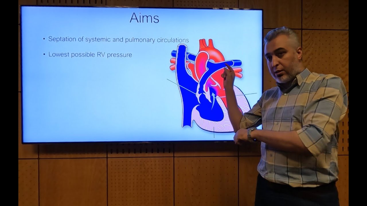 Management of Tetralogy of Fallot - Hatem Hosny
