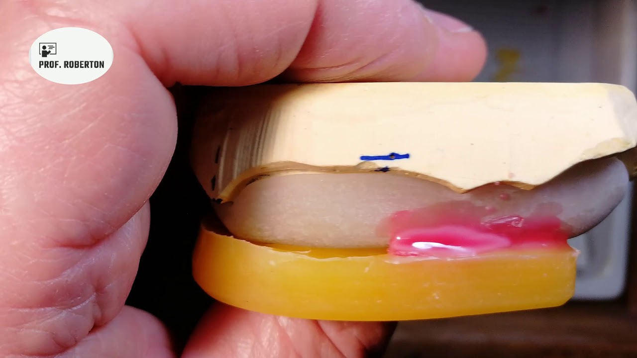 Tutorial Classroom: Vallo di registrazione occlusale superiore su base in resina fotopolimerizzata