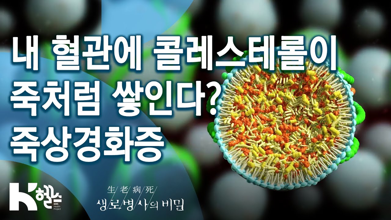 🦠콜레스테롤과 죽상경화증🩸 - 721회(20.01.08) 혈관의 적, 콜레스테롤과 중성지방