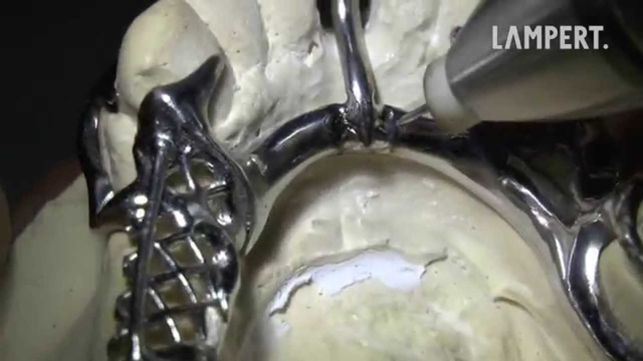 PUK dental welding - retention III