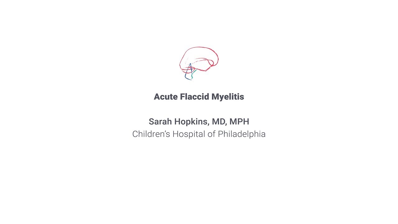 2019 RNDS — Session on the Diagnosis and Treatment of Acute Flaccid Myelitis