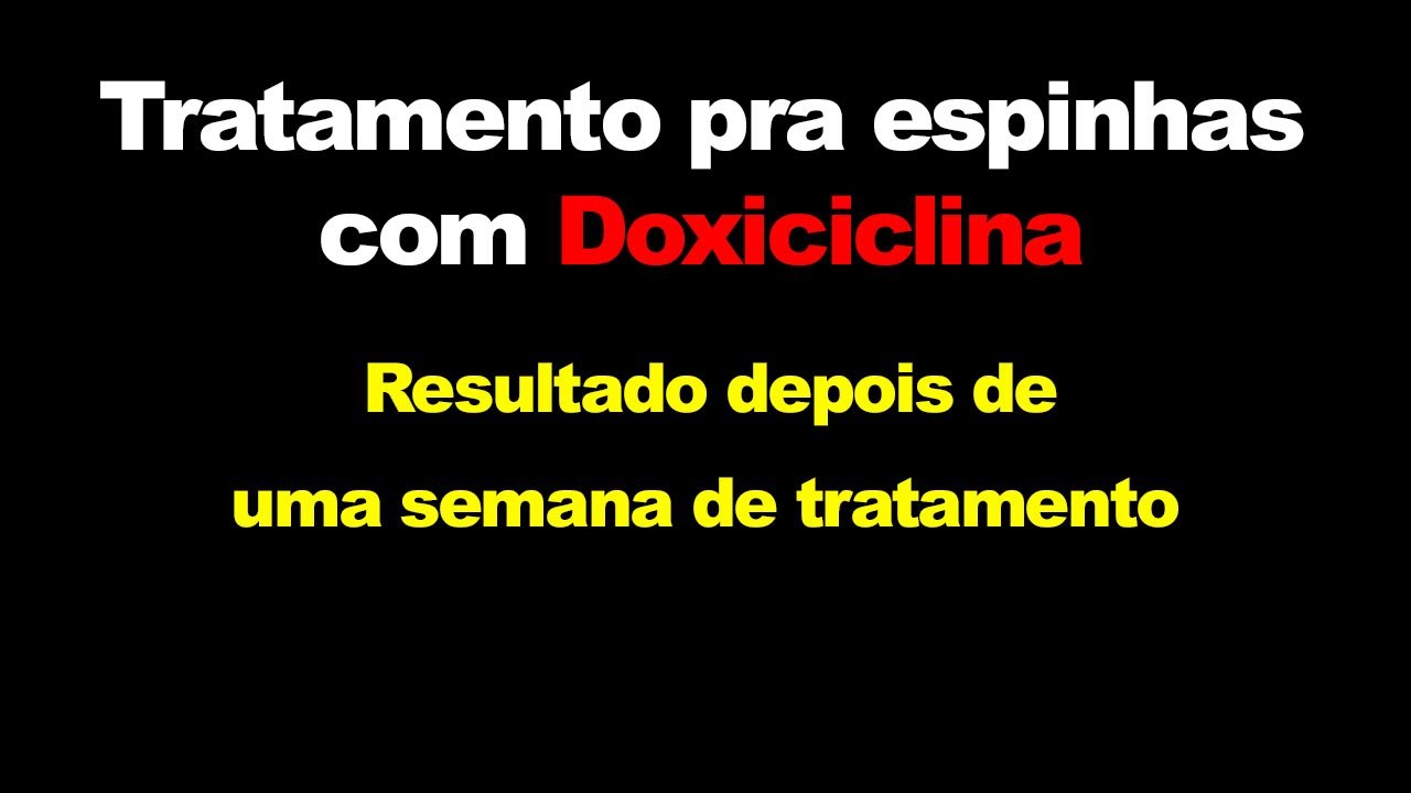Tratamento pra espinhas com Doxiciclina - Resultado depois de uma semana de tratamento