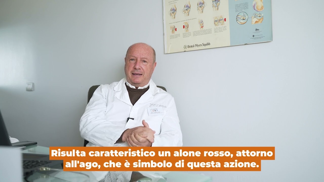 Sindrome Miofasciale: che cosa è, come riconoscerla e come curarla.