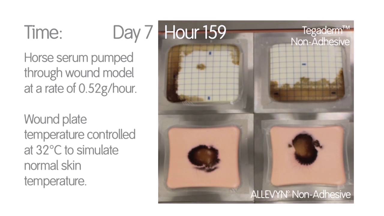 Foam Dressing Comparison - ALLEVYN Non Adhesive vs TegadermTM Non Adhesive