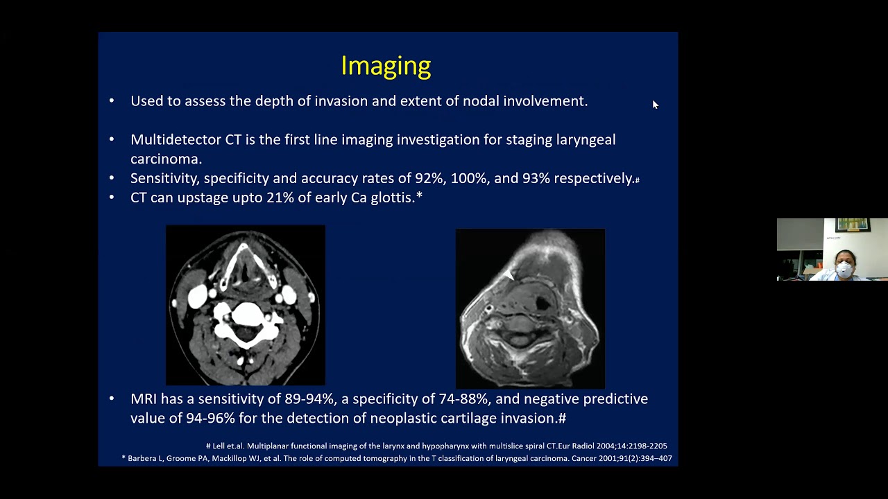 Organ Preservation in Locally Advanced Larynx and Hypopharynx Cancer by Prof Sarbani Ghosh Laskar
