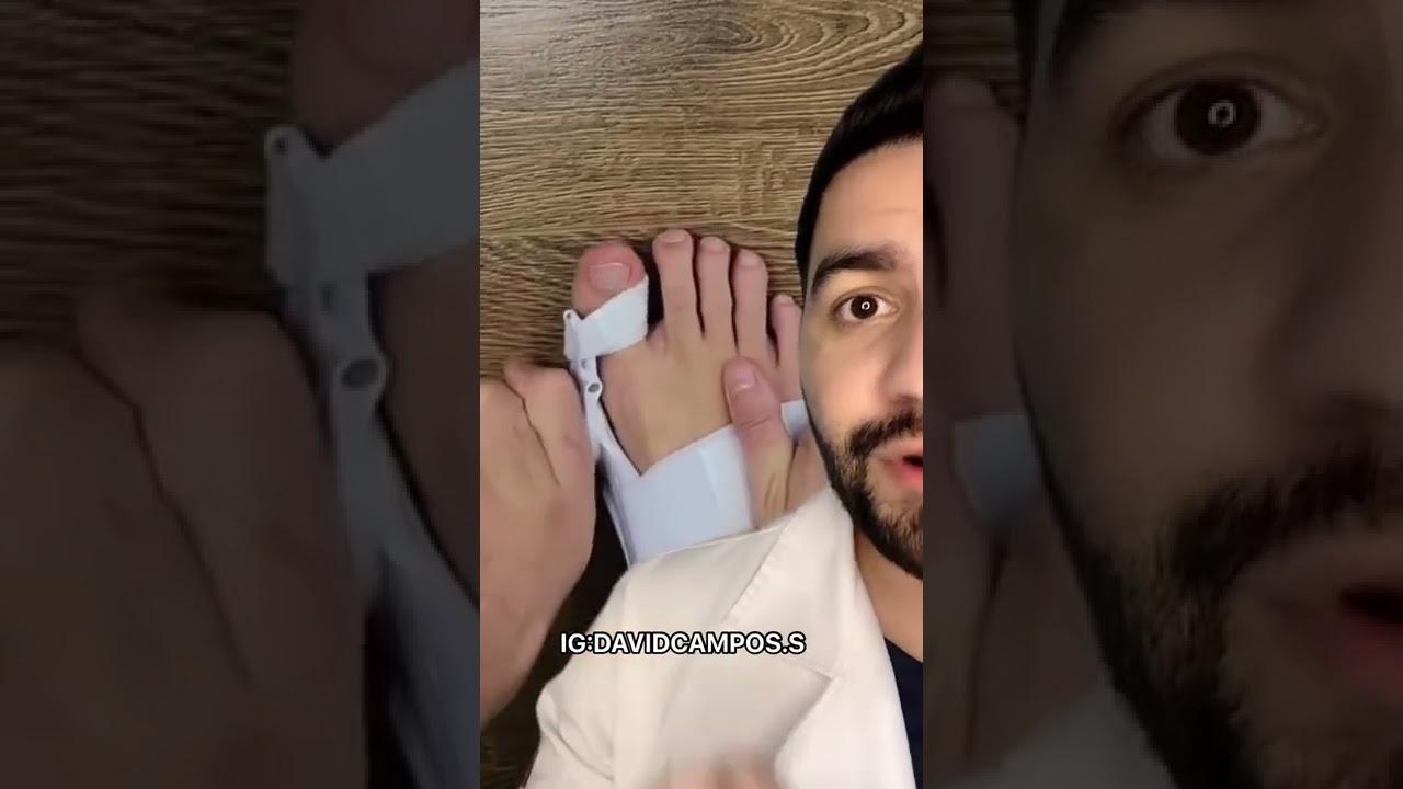 ASI SE CORRIGE LOS JUANETES
