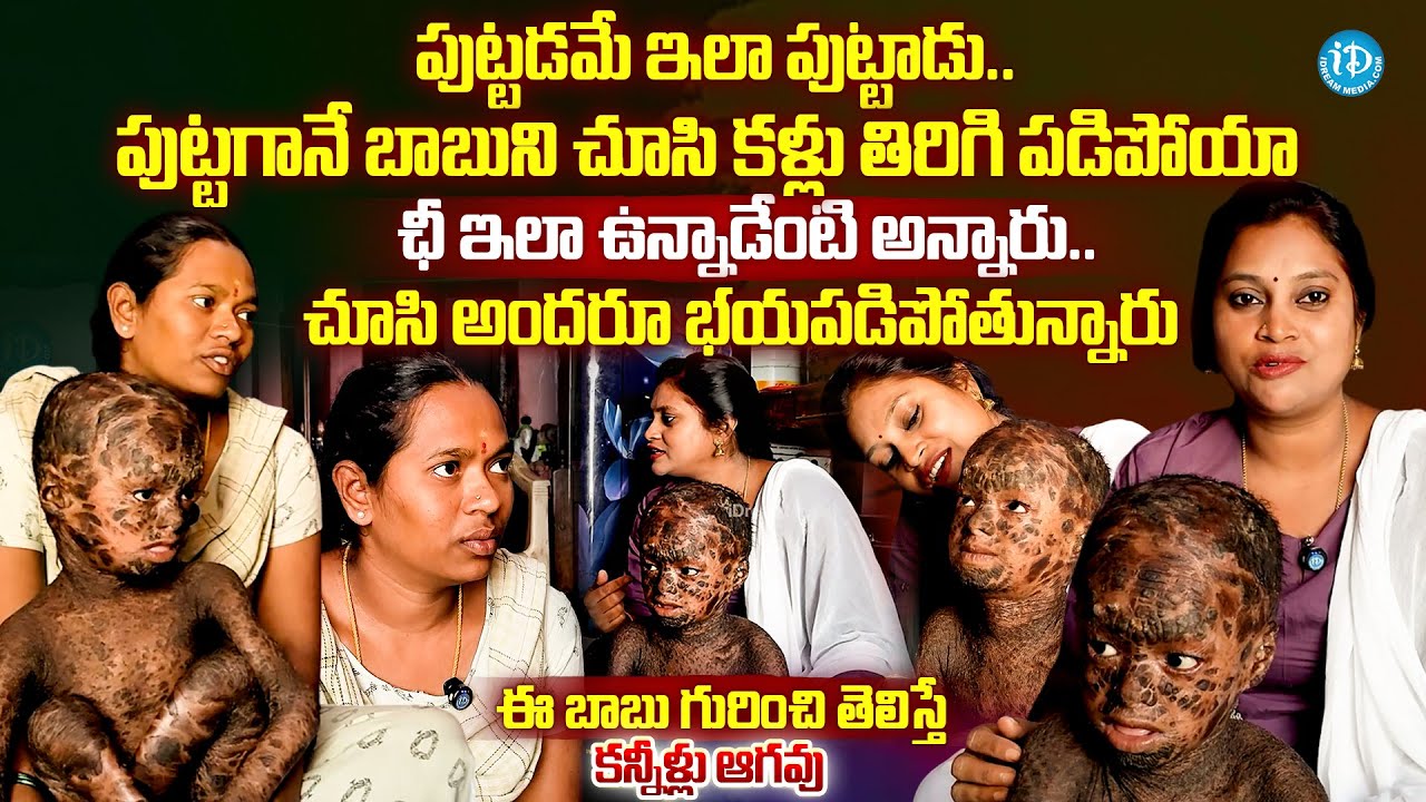 Vizinagaram 9 Years Old Boy Jaya Vardhan Emotional Story |@iDreamMahila