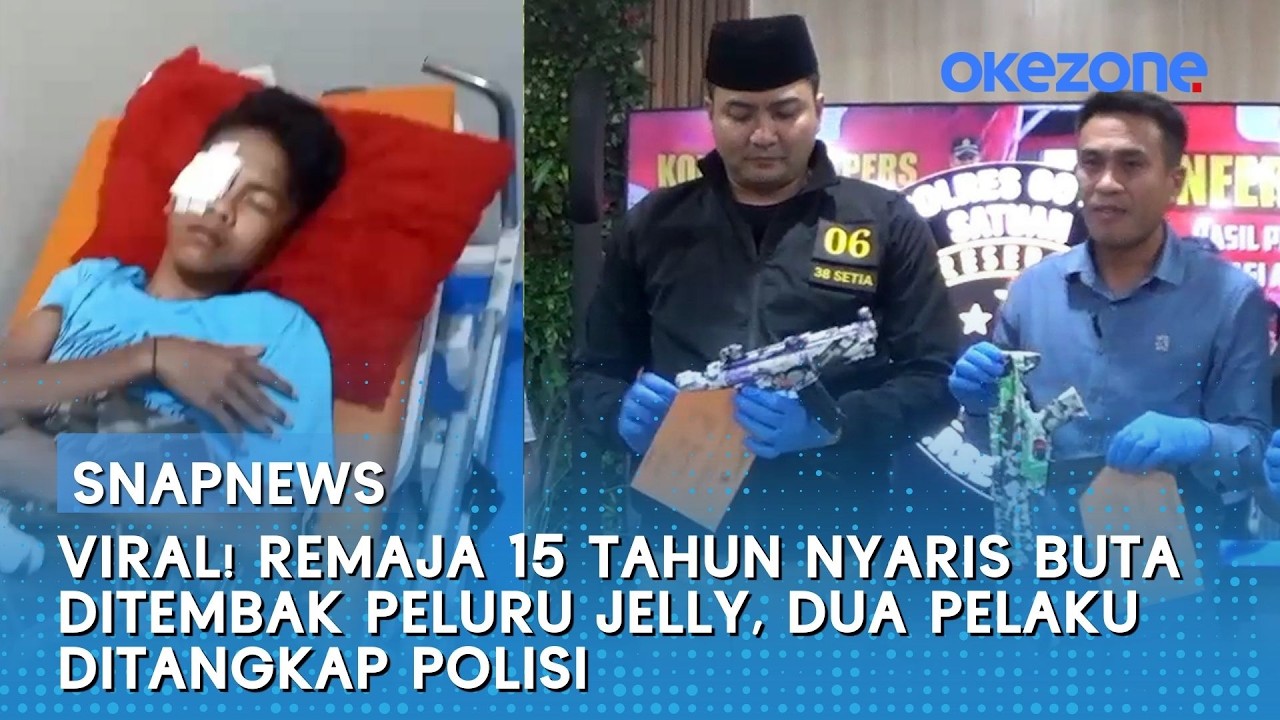 Viral! Remaja 15 Tahun Nyaris Buta Ditembak Peluru Jelly, Dua Pelaku Ditangkap Polisi | Snapnews