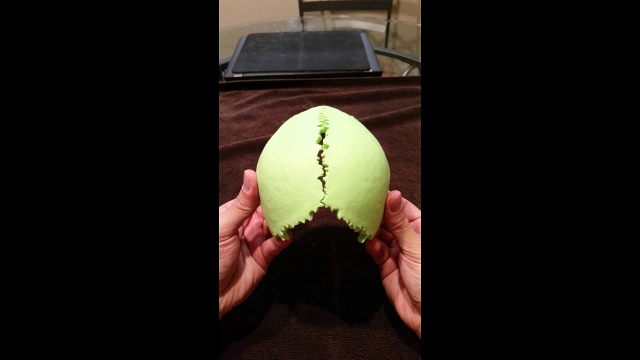 3 Cranial Parietal motion