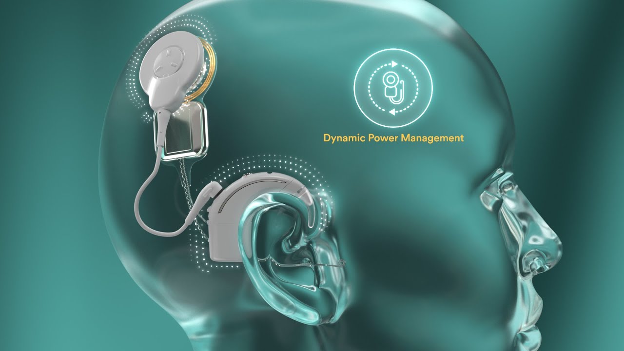 Nucleus Nexa by Cochlear - Medical Product Animation