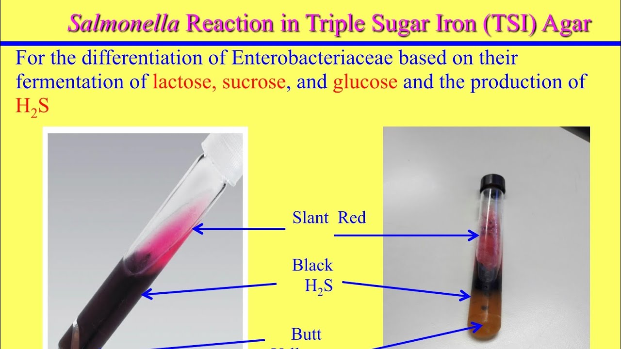 محاضرة السالمونيلا Salmonella Lecture