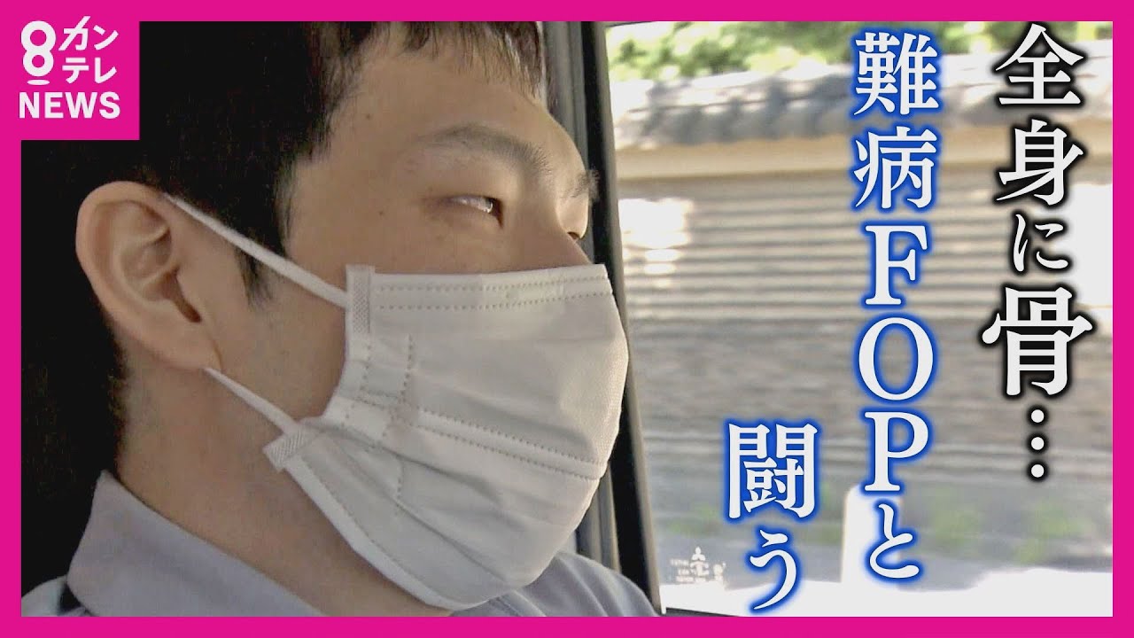 【特集】全身の筋肉が骨になる　難病「FOP」と闘い続ける青年　命を削って自らの皮膚を研究に提供　発症から15年…　全てのFOP患者が“完治する未来”を 夢見て〈カンテレNEWS〉