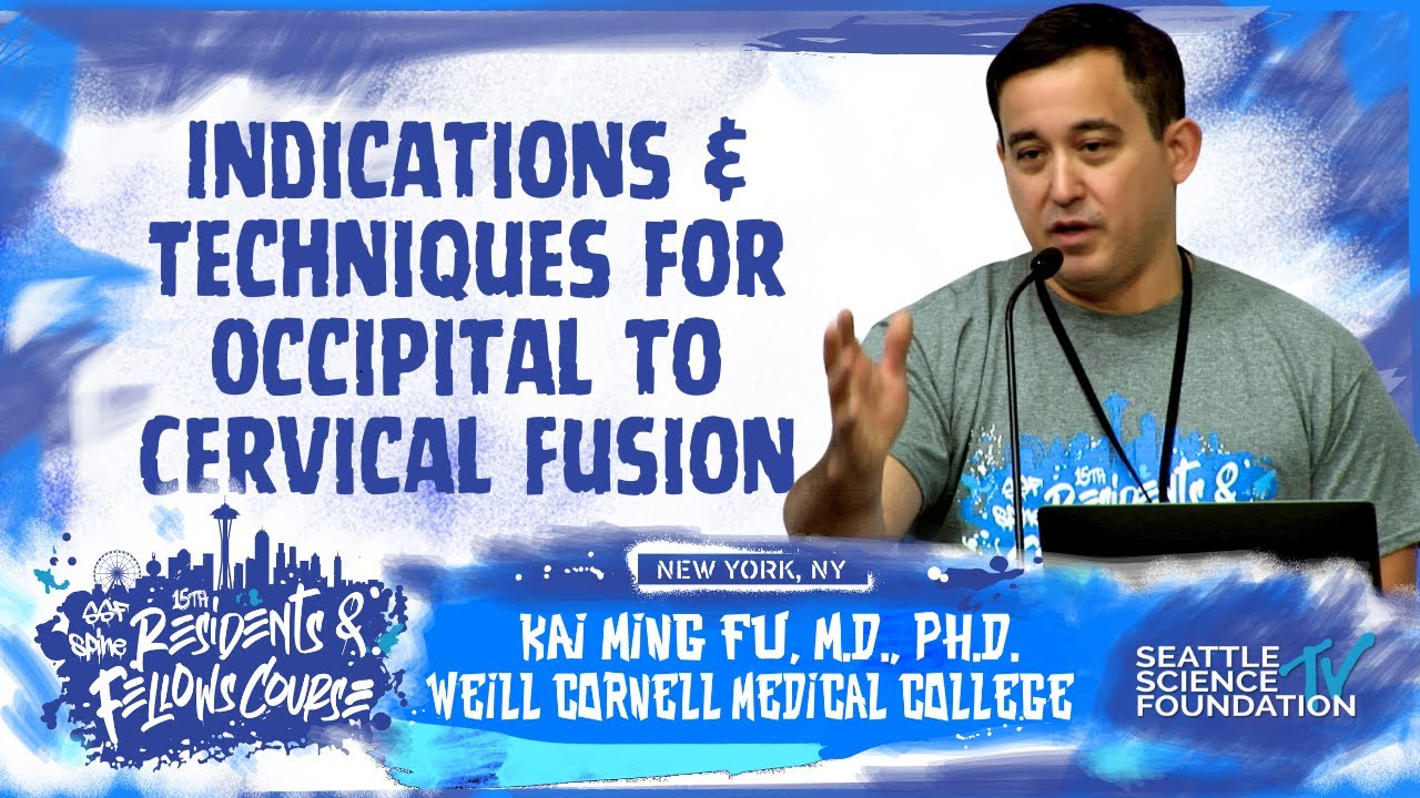 Indications & Techniques for Occipital to Cervical Fusion - Kai Ming Fu, M.D., PhD