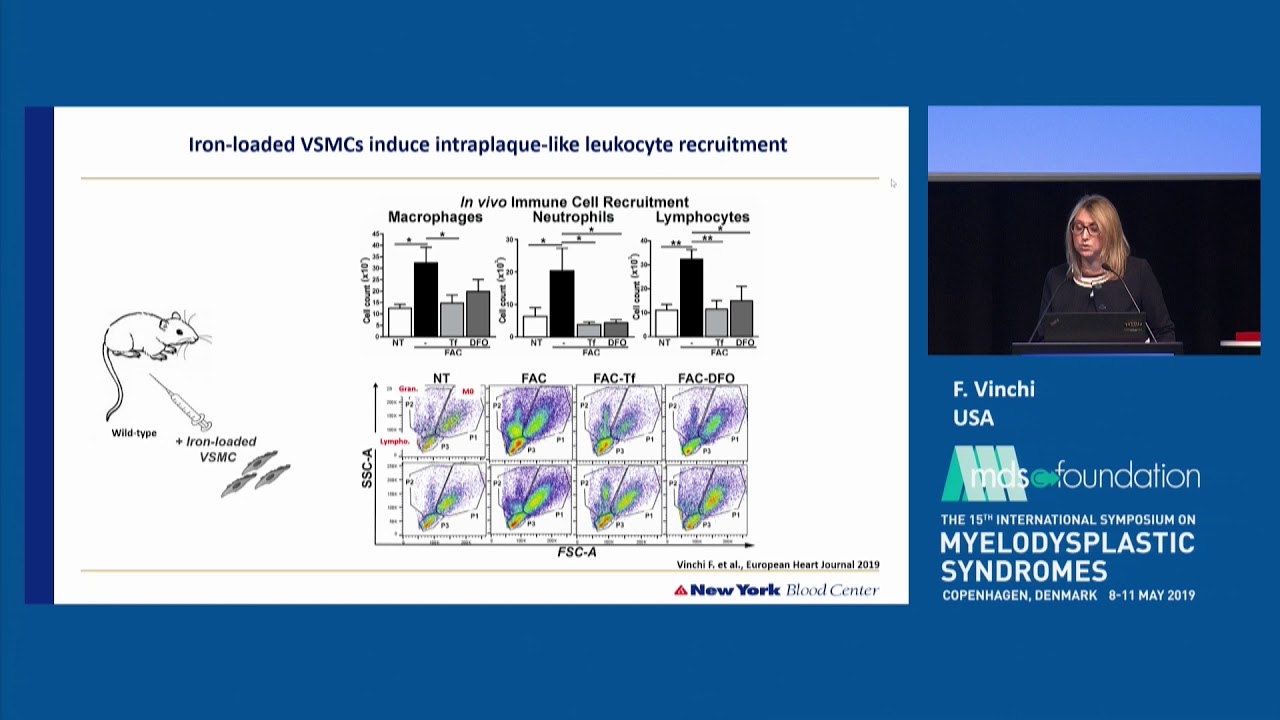 Iron as Potential Risk Factor for Atherosclerosis in Elderly Transfused MDS Patients - F Vinchi