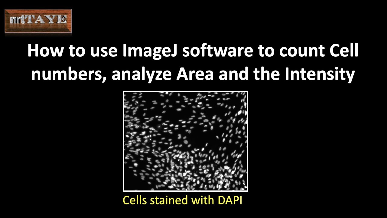 Как использовать программу ImageJ для подсчета количества клеток, анализа площади и интенсивности