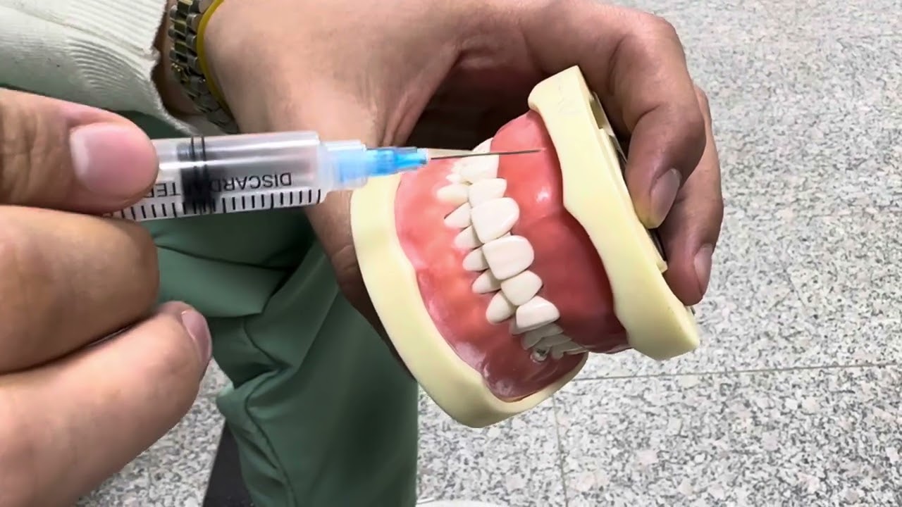 طريقة إعطاء تخدير بالinfiltration طب أسنان مرحلة ثالثة