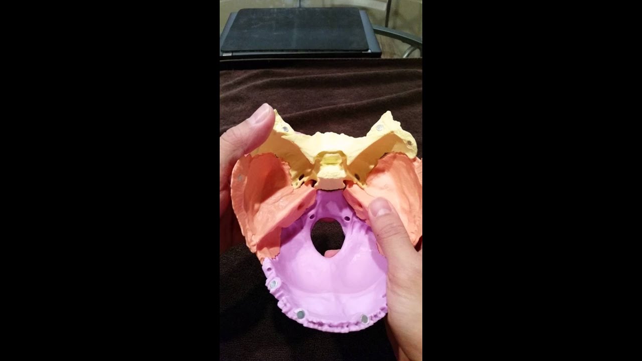 2 Cranial Temporal motion