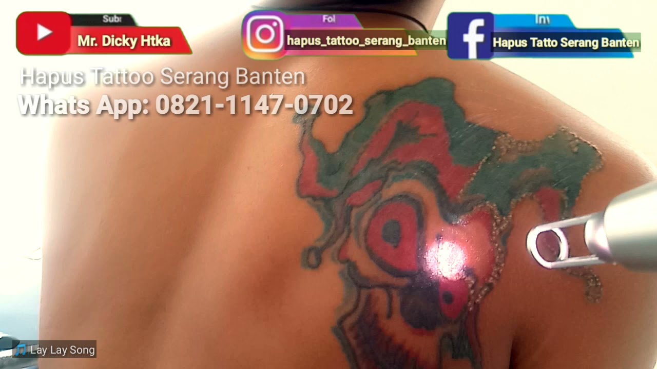 Hapus Tattoo Djoker