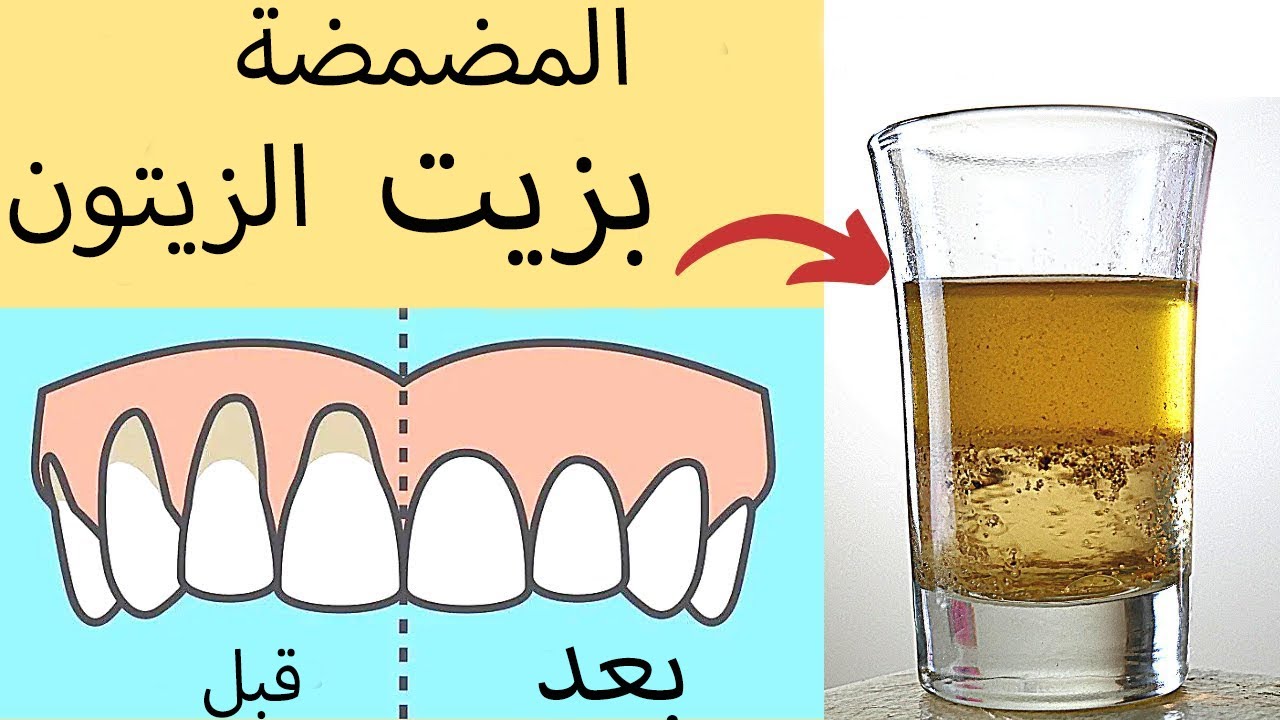أسرار لايخبرك بها طبيب الأسنان عن المضمضة بزيت الزيتون