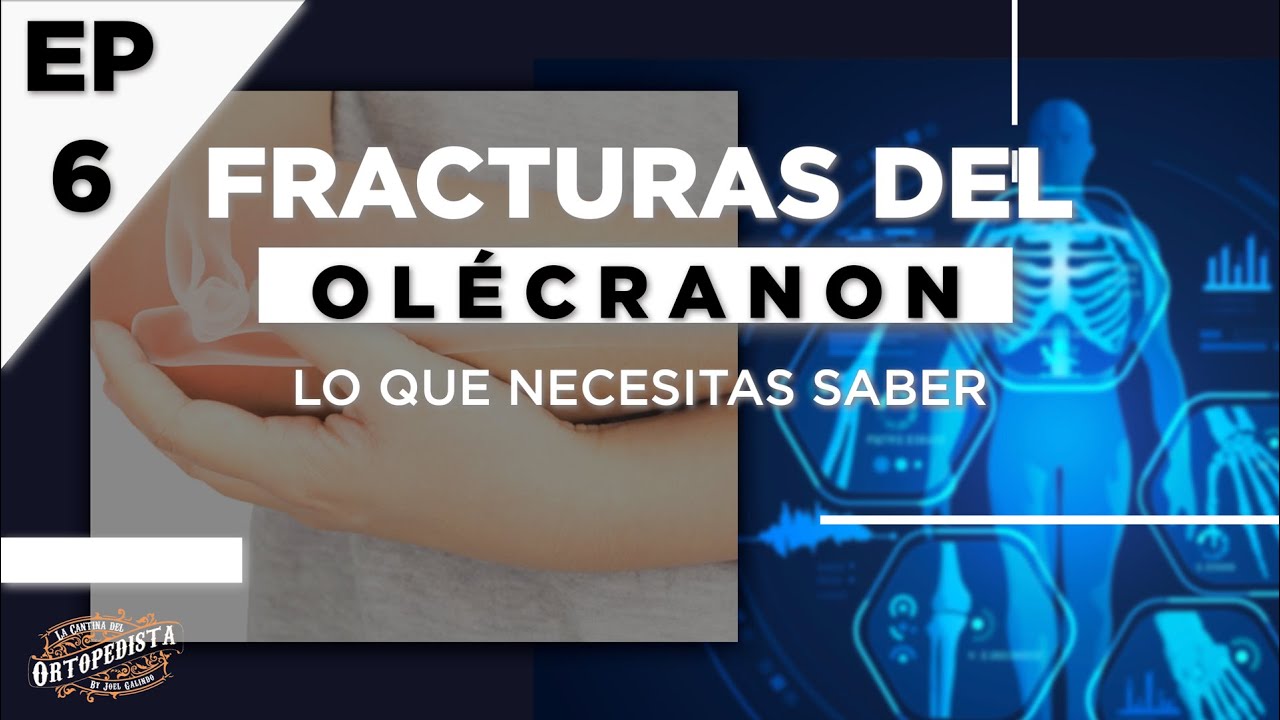 Fracturas del olécranon