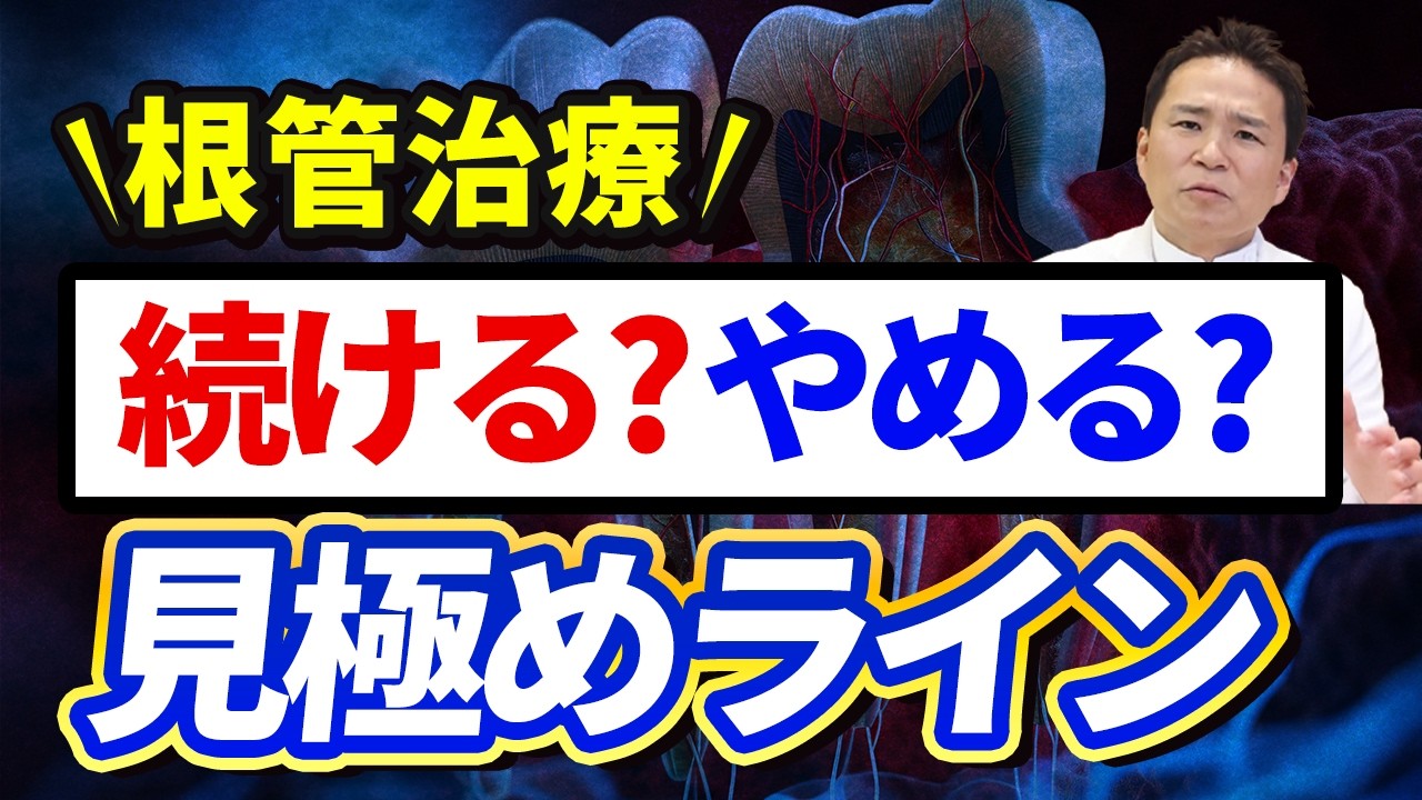 【根管治療】何度も治療して永遠ループ！なんでこんなことになるの？