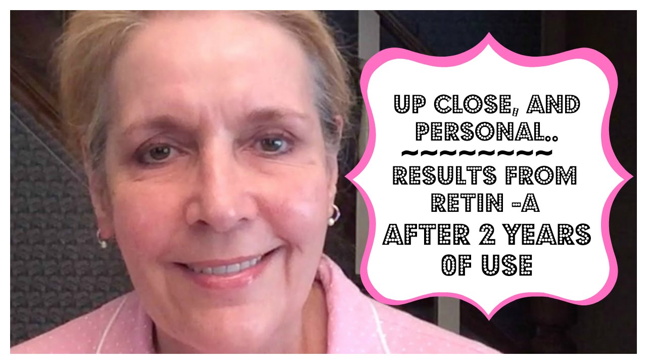 Anti-Aging Update~Results After Using Anti-Aging Skincare for 2 years (Skin care for Men & Woman)