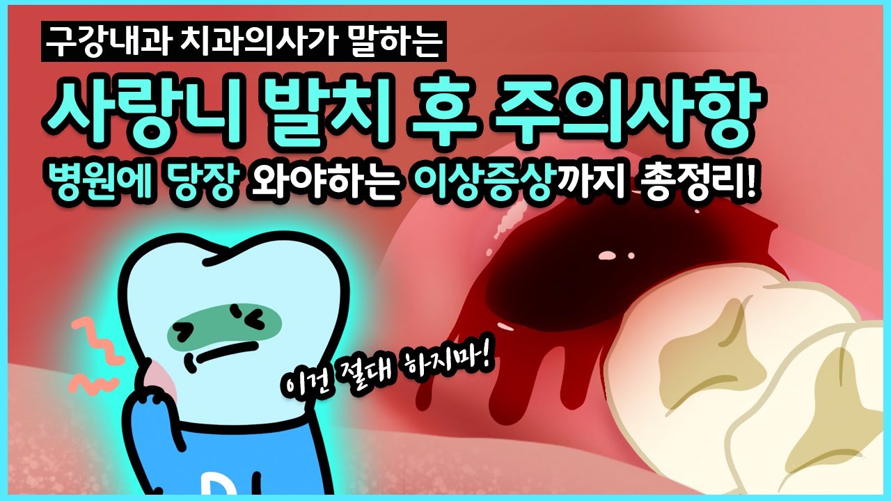 사랑니 발치 주의사항, 관리, 통증과 지혈, 발치 후 병원에 가야 하는 상황까지 완벽 정리