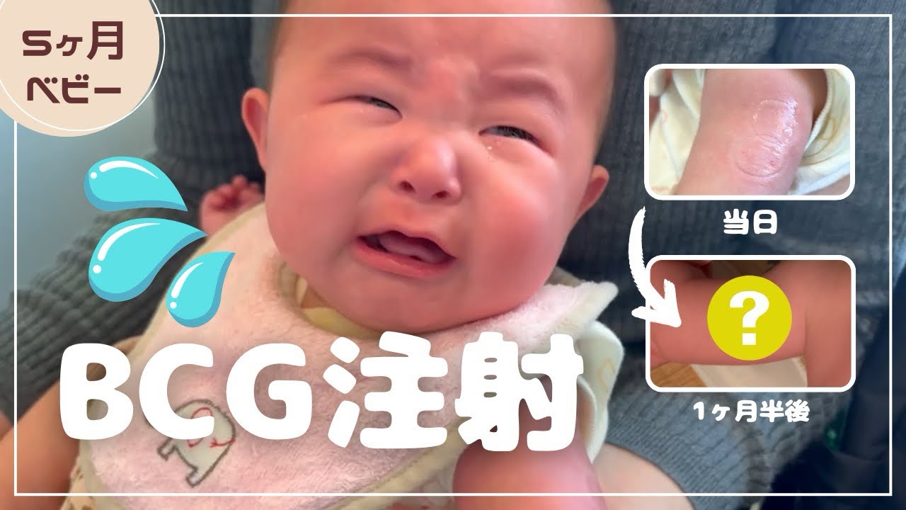 【生後5ヶ月】BCGワクチン接種当日の様子から1ヶ月半の経過 #BCG #ハンコ注射 #5ヶ月ベビー