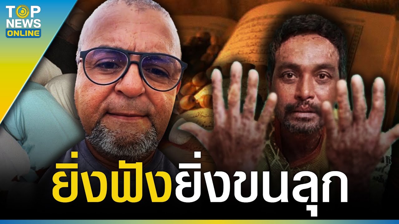 “ลุงออสติน” ฝากถึง “วินัย ไกรบุตร” แก้โรคเวรโรคกรรม ผมหายมาแล้ว | TOPUPDATE