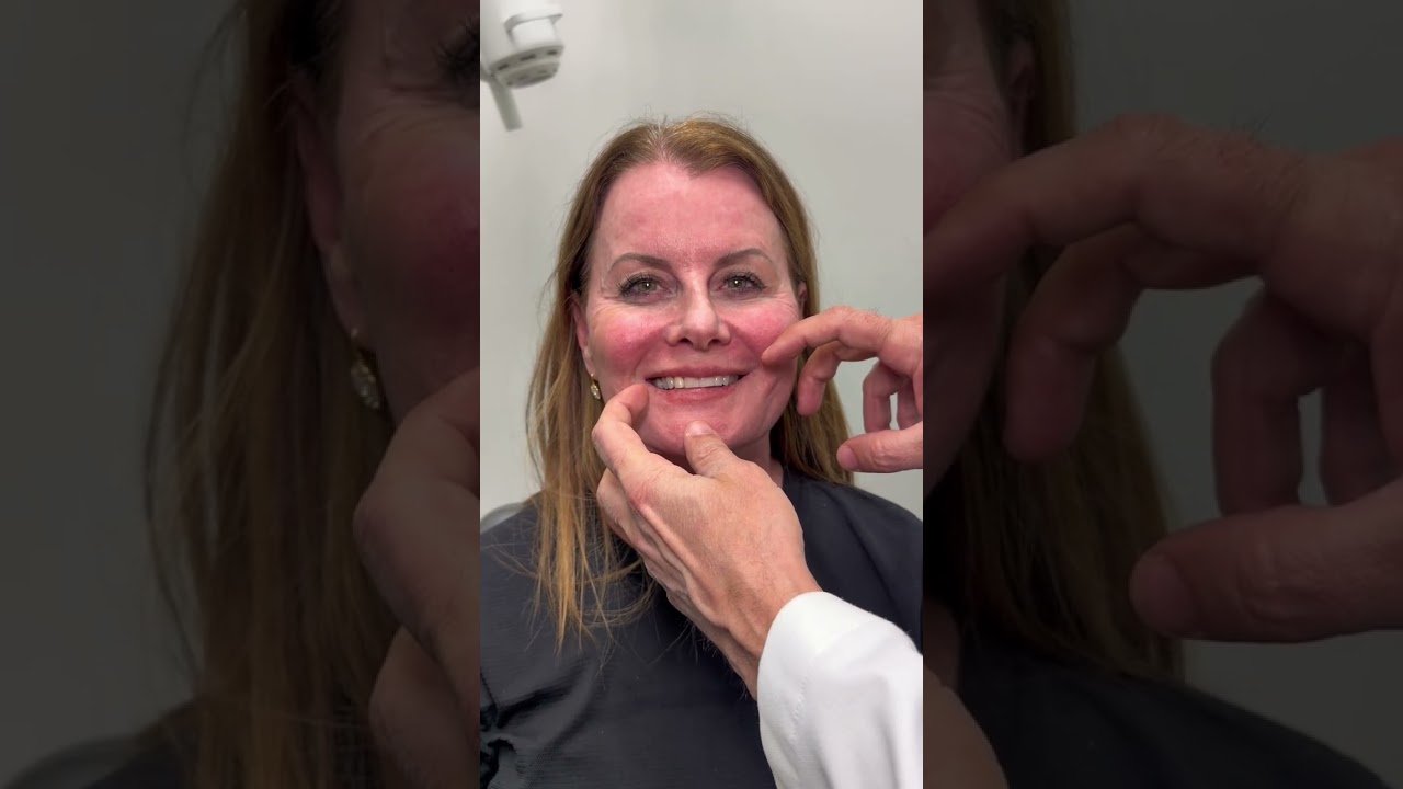 Debbie and Mark Rejuvenation Journey | Dr. Ramtin Kassir | New York City 