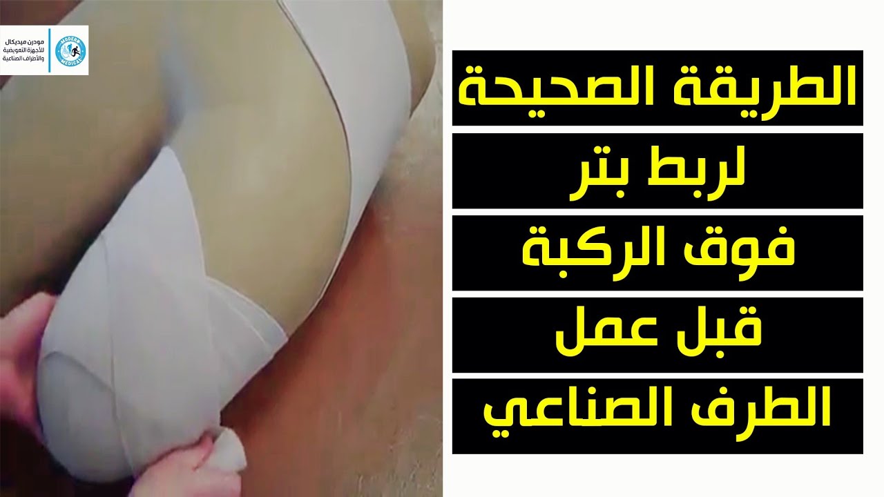 الطريقة الصحيحة لربط بتر فوق الركبة قبل عمل الطرف الصناعي