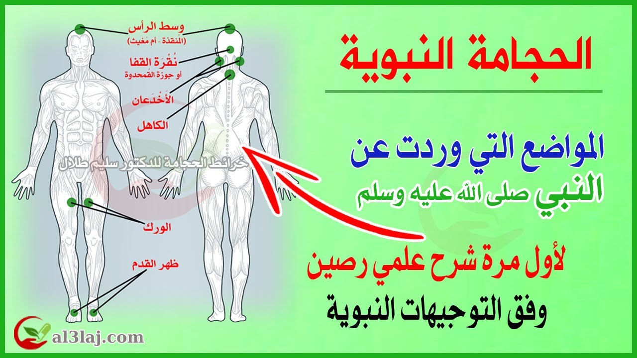الحجامة النبوية | المواضع التي احتجم عليها النبي #الحجامة