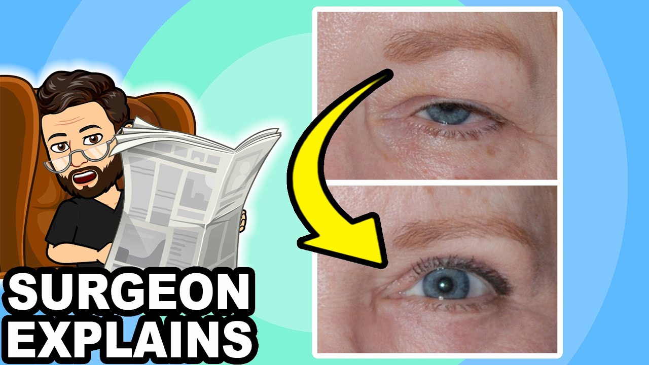 Is droopy eyelid SURGERY painful? Surgeon Answers