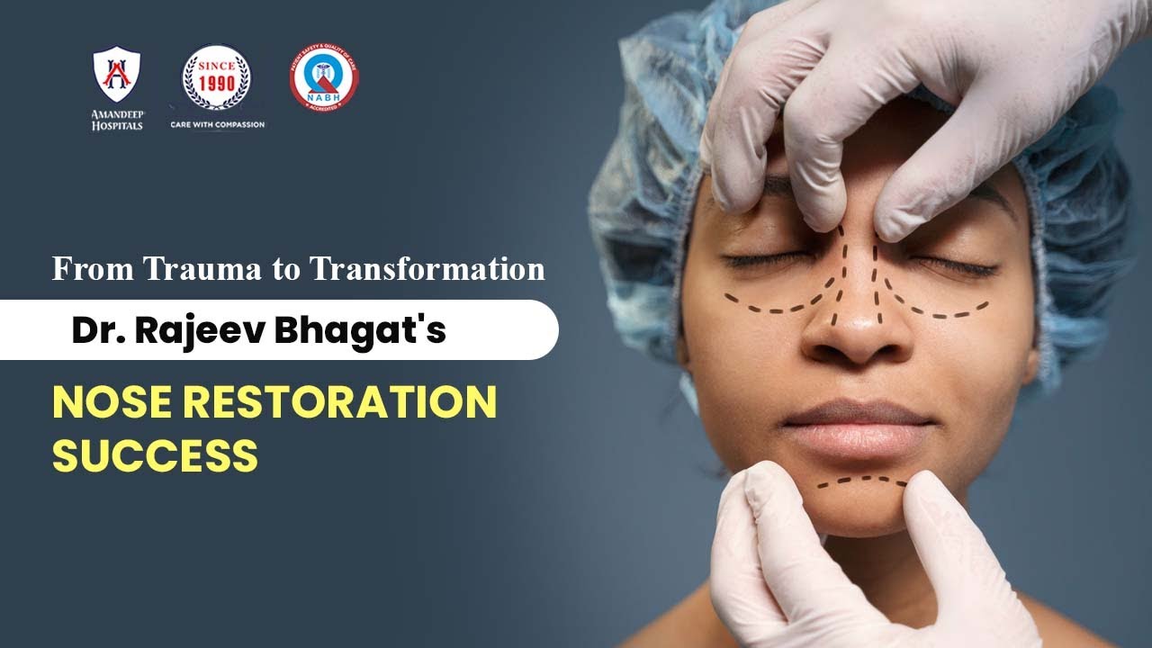 Dr. Rajeev Bhagat's Remarkable Treatment of a Severely Damaged Nose After a Road Accident