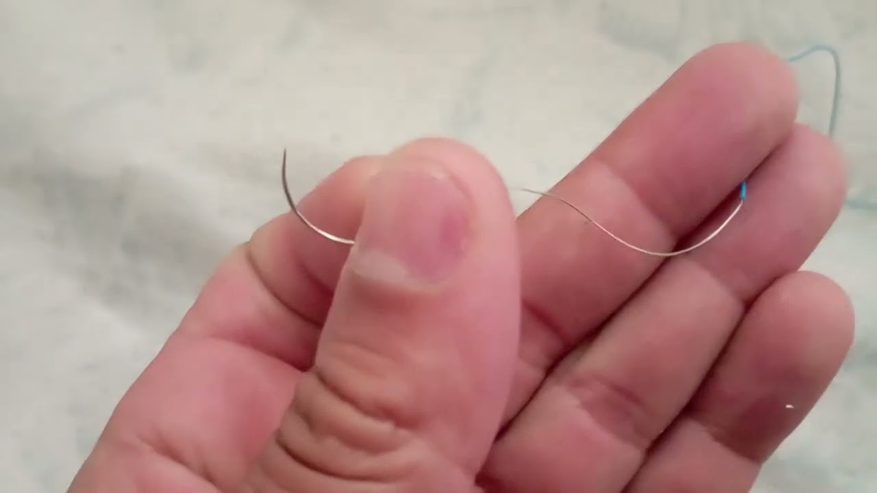 Fio de Marcapasso Temporário para Cirurgia Cardíaca.