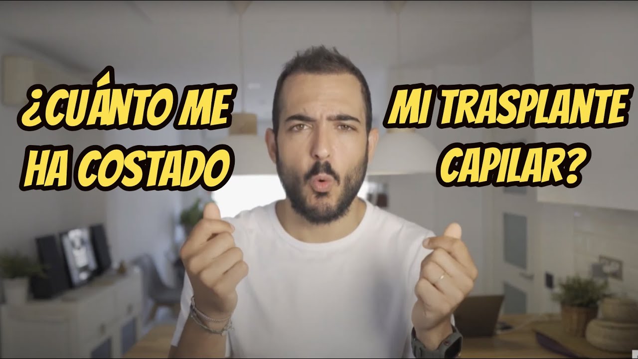 ¿Cuánto cuesta un trasplante capilar en España? Cuánto me ha costado a mí? Evolución 4 meses y 1/2