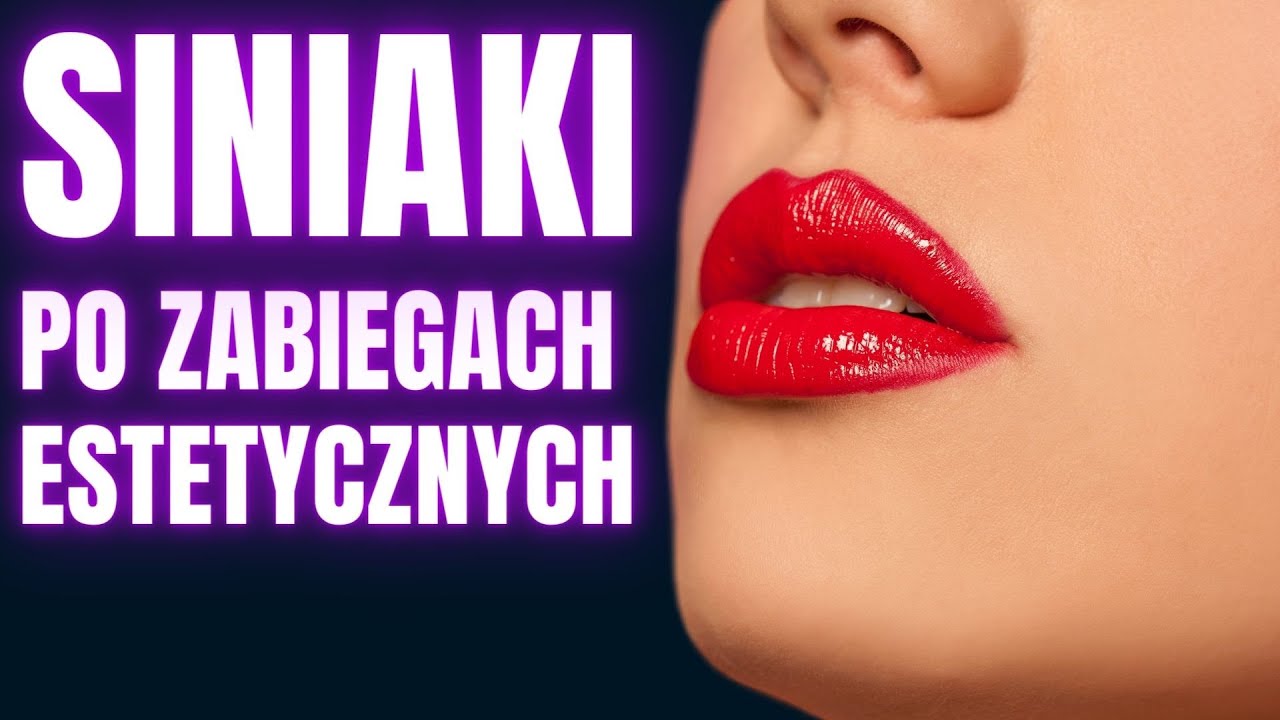 Co Na SINIAKI Po Powiększaniu Ust?