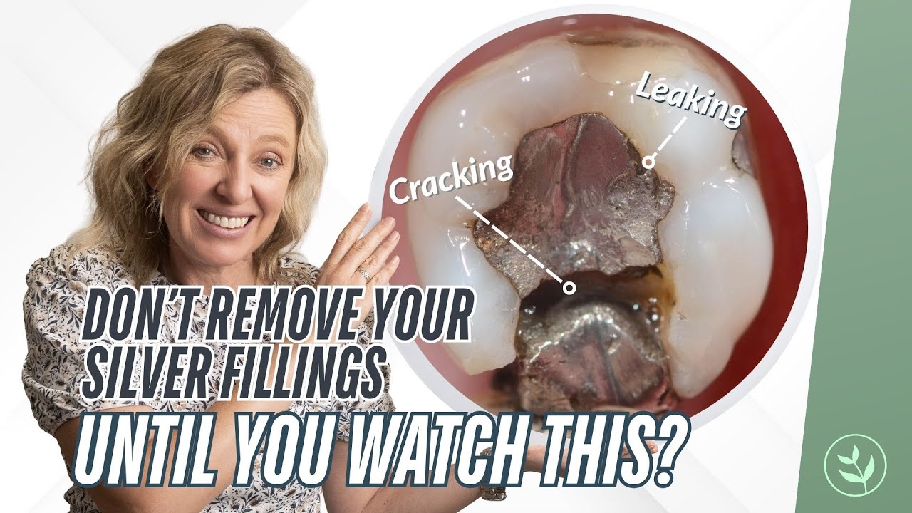 Exposing the Truth About Mercury Fillings (And What Your Dentist Won&rsquo;t Tell You)