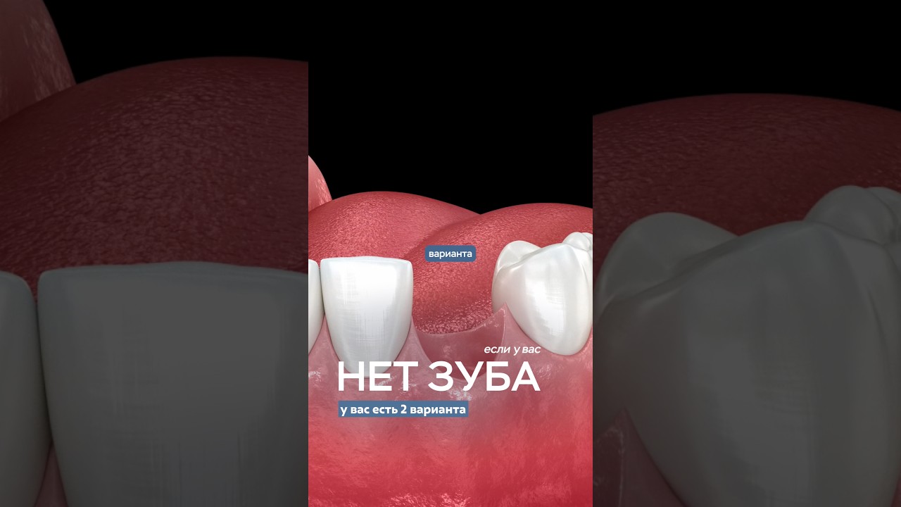 📞 Запись: +78122504093