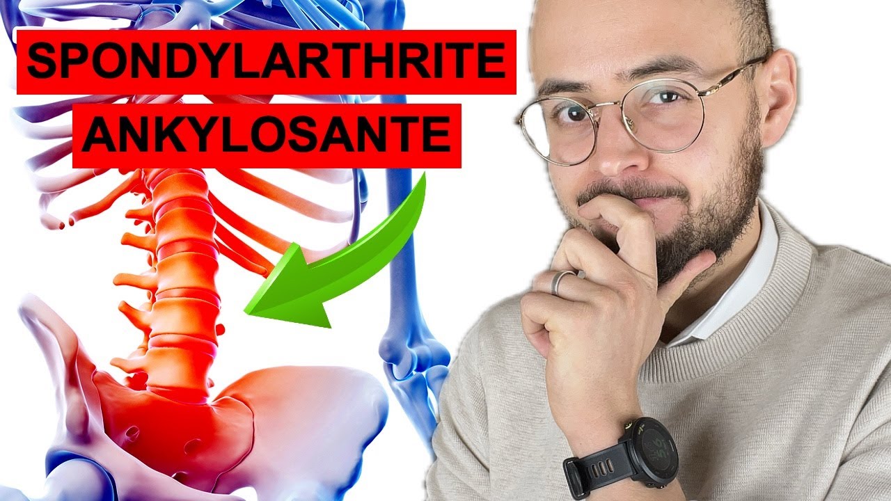 La Spondylarthrite ankylosante : les symptomes d'un mal  de dos pas comme les autres.