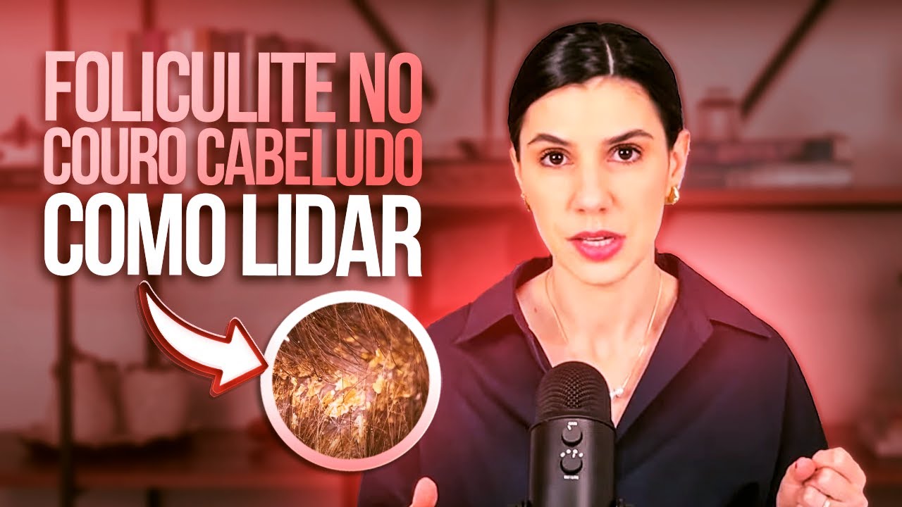 O que voc&ecirc; precisa saber sobre FOLICULITE no COURO CABELUDO