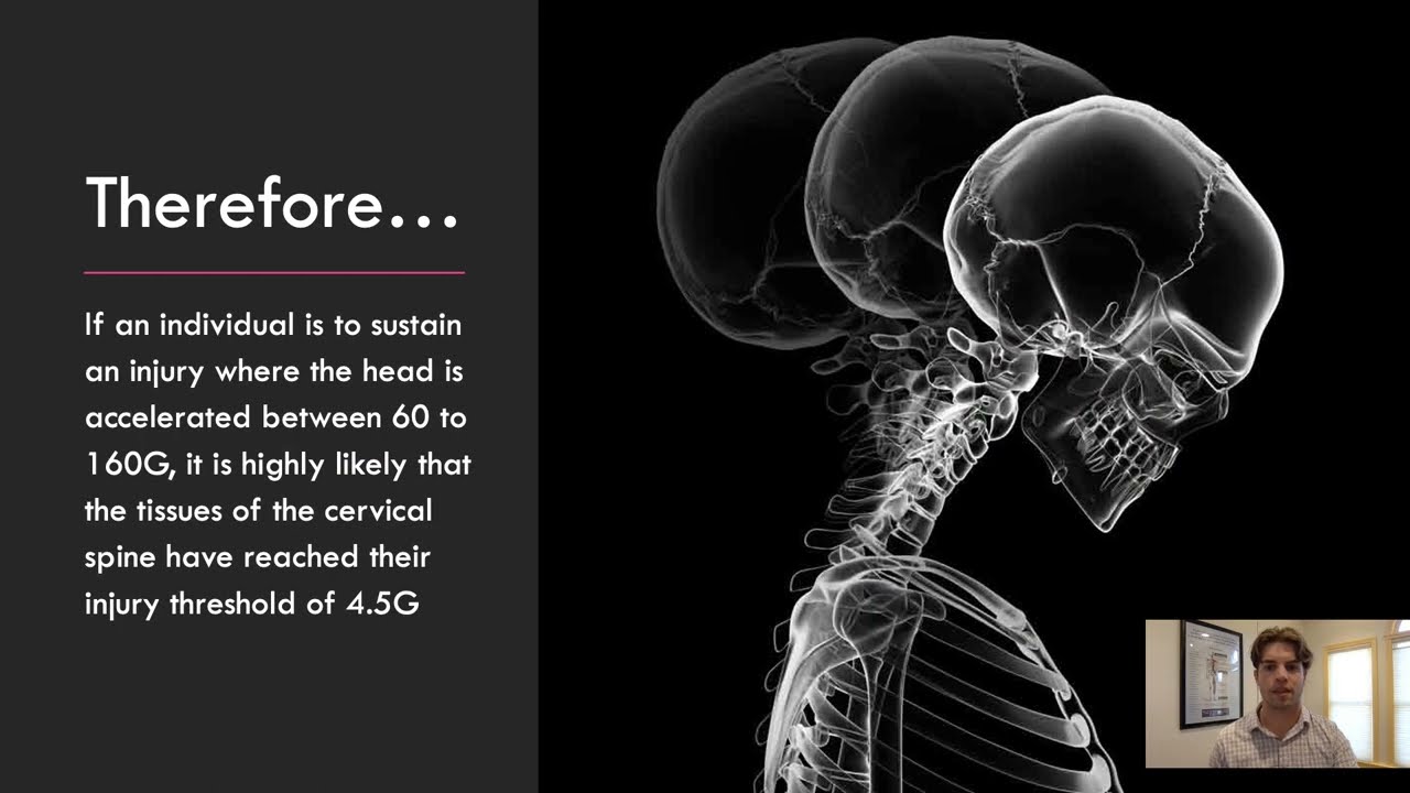 Concussion and Whiplash Upper Cervical Chiropractic Care